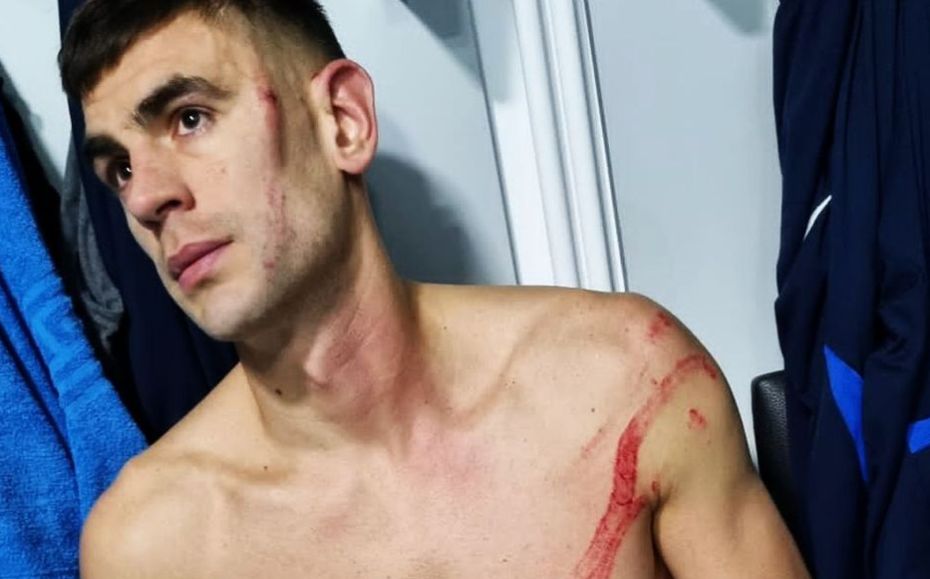 FCSB a învins pe FC Voluntari! Edjouma, fault dur asupra lui Igor Armaș: „Putea să mă desfigureze. Am urme şi pe cap, pe faţă, pe corp”