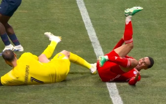 Musiala s-a accidentat grav la meciul cu PSG